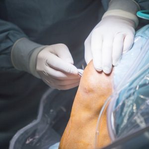 Orthopaedic Drapes - Image 3